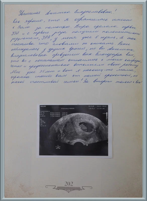 За вторым только к вам!