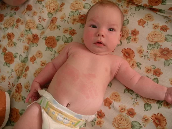 За вторым малышом придем к Вам же
