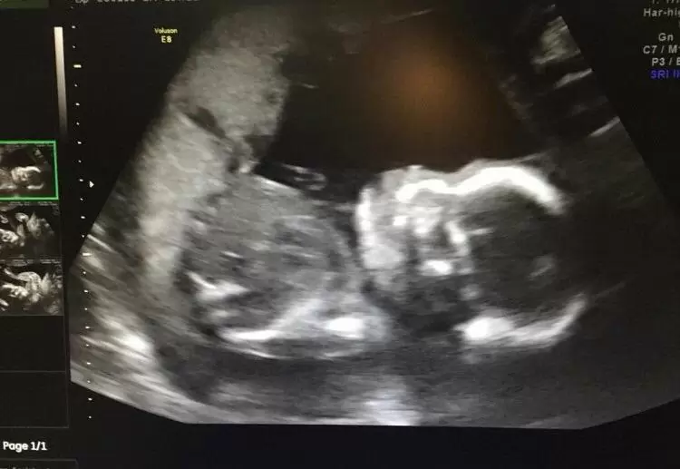 С первого раза у нас все получилось!