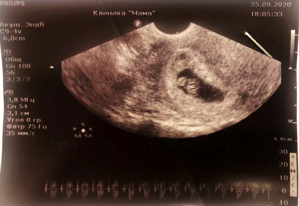 Самомама без принца