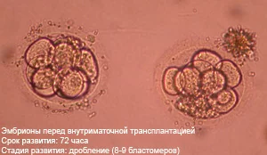 Я бы не пошла на ЭКО, если...