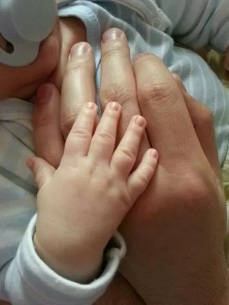 Успешное ЭКО, когда плохая спермограмма. История успеха