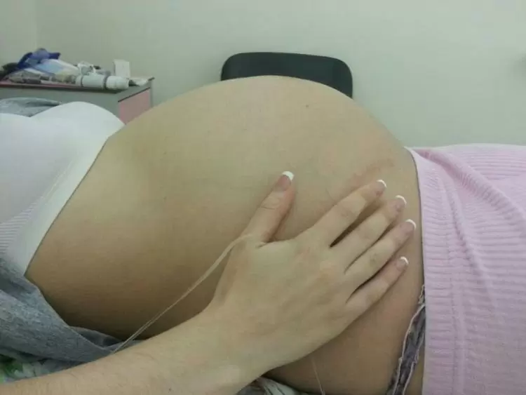 Успешное ЭКО, когда плохая спермограмма. История успеха