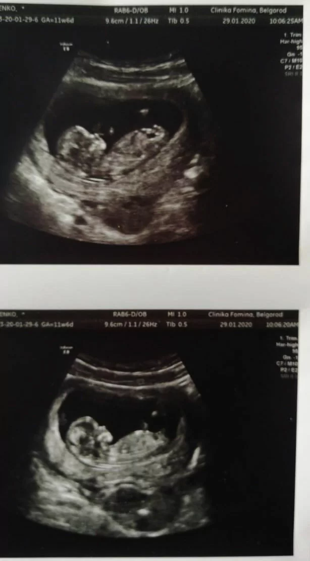 Врачи, эмбриологи спасибо за Вашу тонкую, чуткую работу!