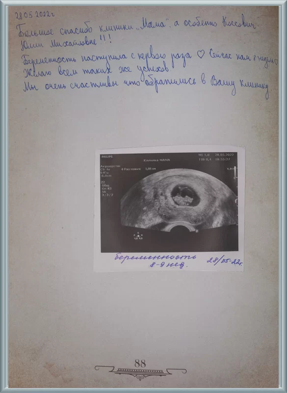 Беременность наступила с первого раза!