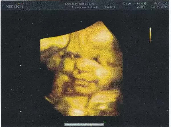 Спасибо всей "МАМЕ" за наше СЧАСТЬЕ