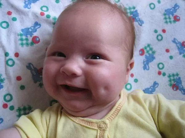 Здравствуйте, наш дорогой доктор! Низкий поклон всем-всем сотрудникам Клиники «МАМА» за наше чудо.
