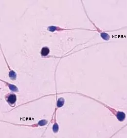 Сперматозоиды под миркоскопом при проведении спермограммы
