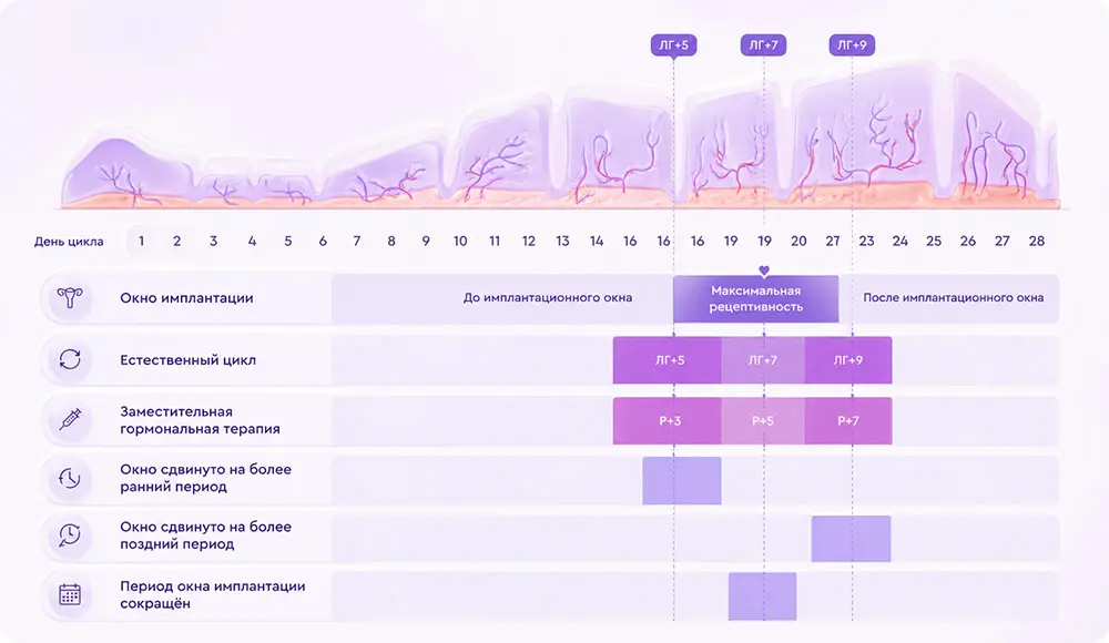 Окно имплантации
