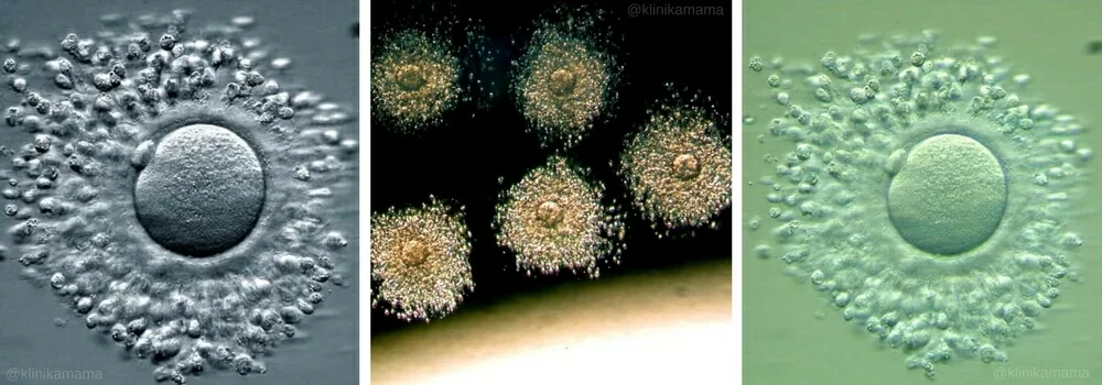 Эмбриология Клиники МАМА