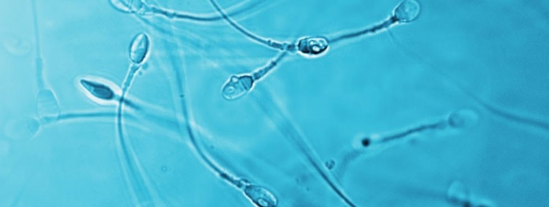 ICSI-MAKC — Микроскопический Анализ Качества Сперматозоидов для ICSI