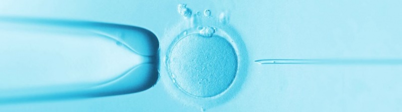  ICSI — инъекция сперматозоида в яйцеклетку